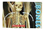 Body Basics: Bones